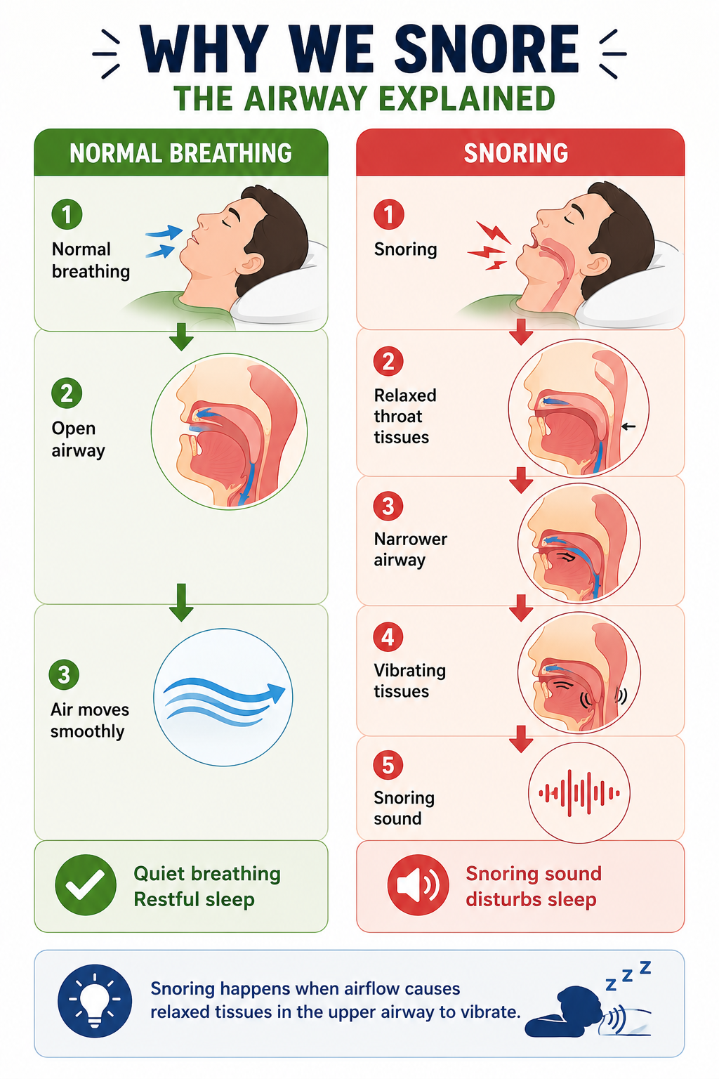 How snoring happens when relaxed throat tissues narrow the airway