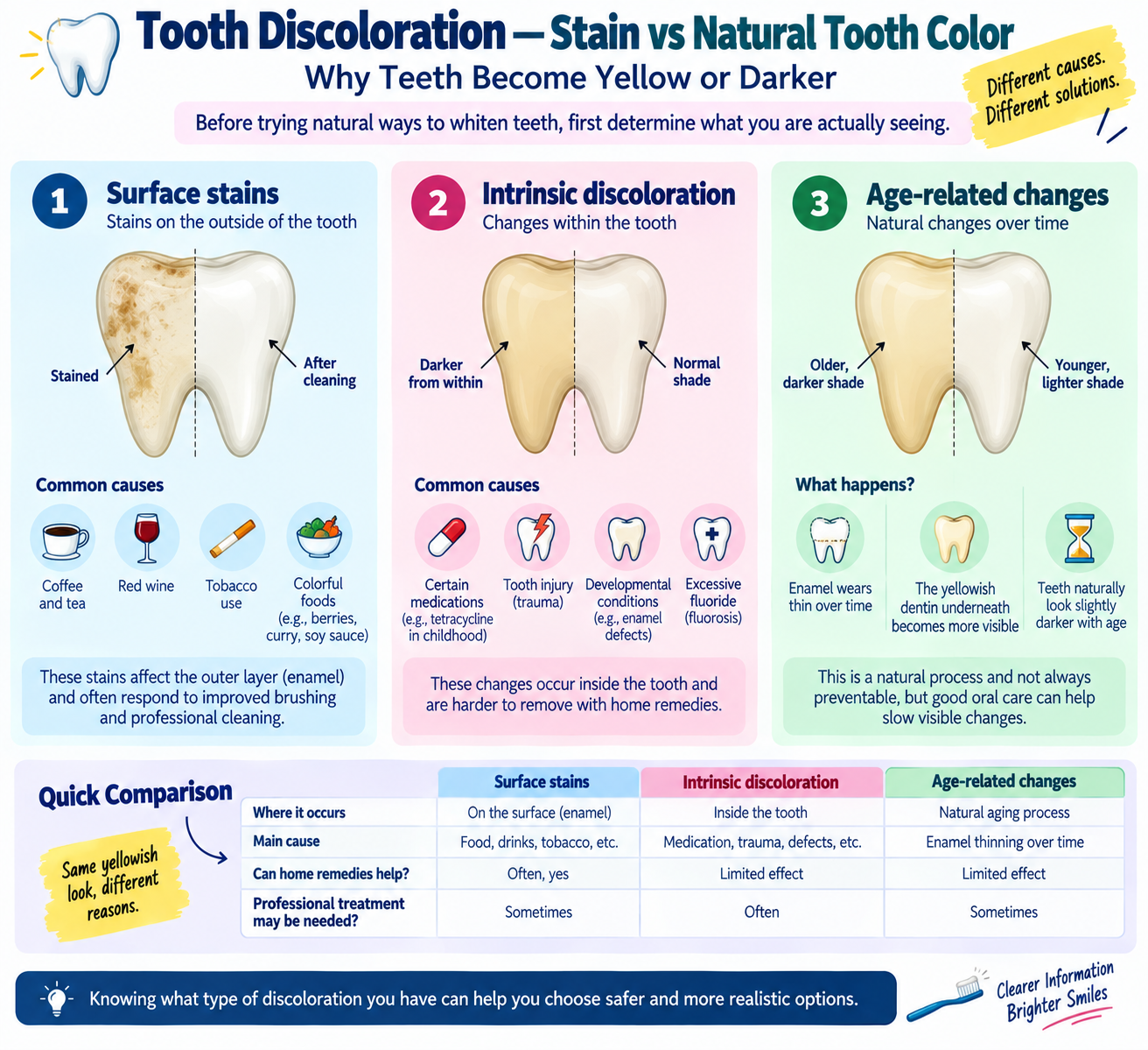 Infographic showing how to distinguish surface tooth stains from natural tooth color and possible dental problems
