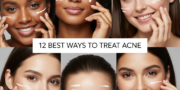 Treat Acne