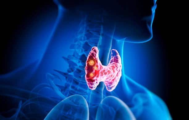 hyperthyroidism in elderly